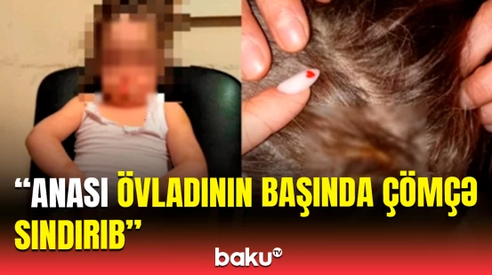 Bədənində sağlam yeri yoxdur | Ananın uşağına etdiyi dəhşətli əməllər ifşa olundu