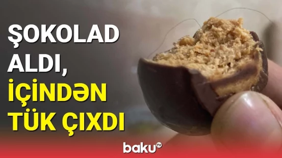 Şokolad aldı, içindən tük çıxdı