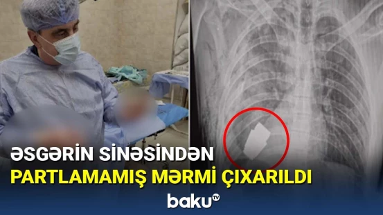 Əsgərin sinəsindən partlamamış mərmi çıxarıldı