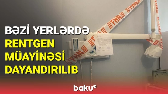 Bəzi yerlərdə rentgen müayinəsi dayandırılıb