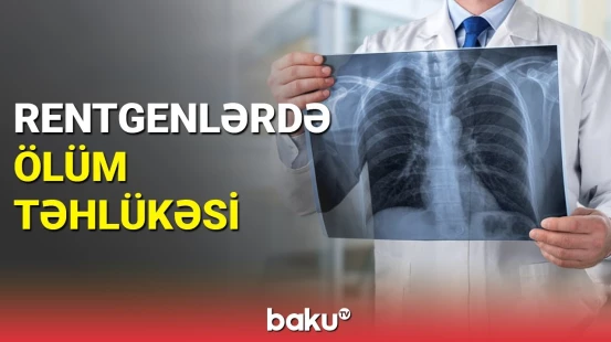 FHN-dən rentgenlərlə bağlı əhaliyə xəbərdarlıq
