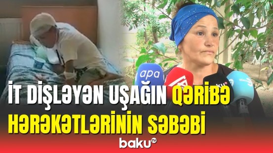 Sumqayıtda quduzlaşdığı deyilən azyaşlının anası danışdı