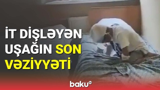 TƏBİB quduzlaşdığı deyilən azyaşlı ilə bağlı açıqlama yaydı