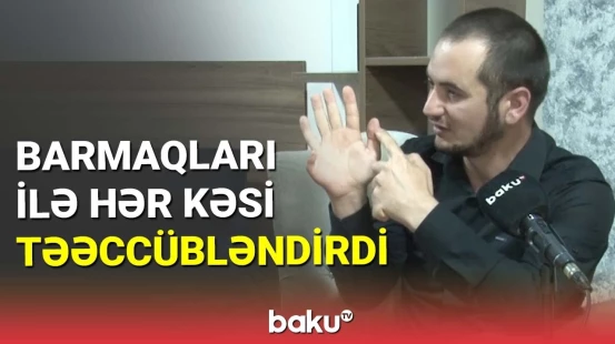 25 barmağa sahib Abşeron sakini