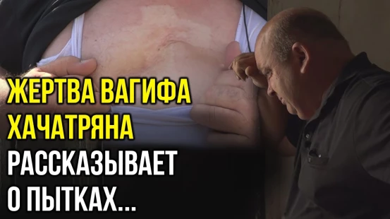 Спустя Годы, Плененный Армянами Маил Мамедов, Испытал Ужас Там, Где Его Пытали