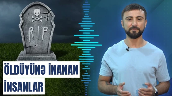 Gəzən cəsəd sindromu nədir?