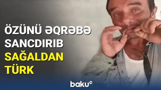 Əqrəbləri ağzına alan türkün müalicə sirri