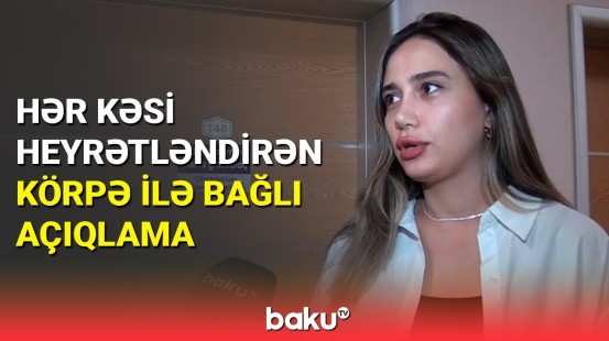 Görünüşü müzakirələrə səbəb olan körpənin həkimi danışdı