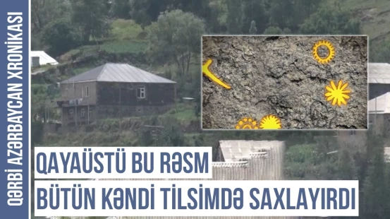 Bu kəndin camaatı şəkər xəstəsi olmurdu