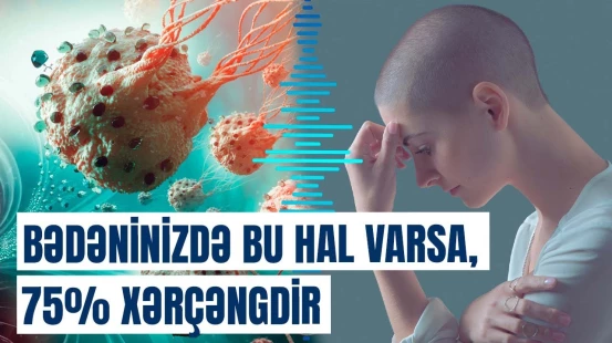 Xərçəngin genetik səbəbi ortaya çıxdı: Bu əlamətlər varsa, həkimə müraciət edin