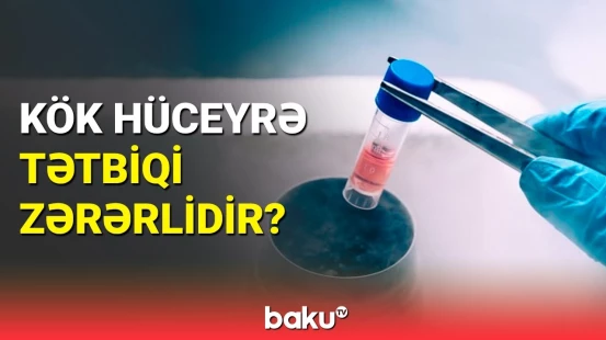 Həkimdən kök hüceyrə tətbiqi açıqlaması: bərpa edir, yoxsa...?
