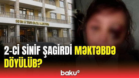 Bakıda 2-ci sinif şagirdinə görə müəllimə töhmət verildi
