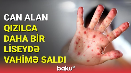 Lisey qızılcaya görə distant təhsilə keçdi