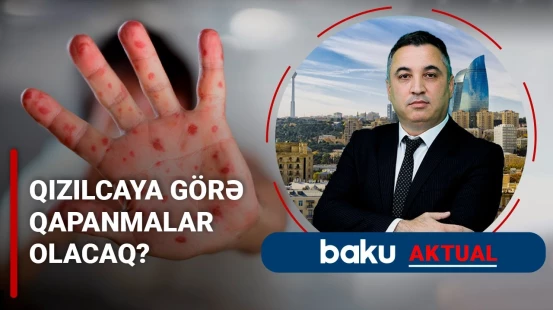 Qızılcaya görə qapanmalar olacaq?