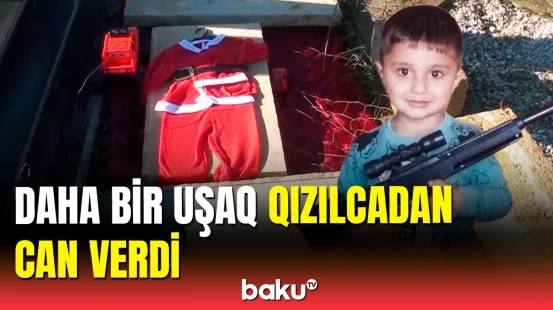 Lənkəranda bədbəxt hadisə | 3 yaşlı oğlan qızılcadan həyatını itirdi
