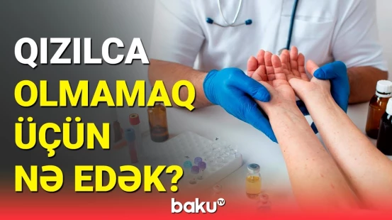 Qızılcadan qorunmanın yolları | İnfeksionistdən faydalı məsləhətlər