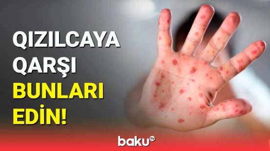 Səhiyyə Nazirliyindən əhaliyə qızılca barədə müraciət