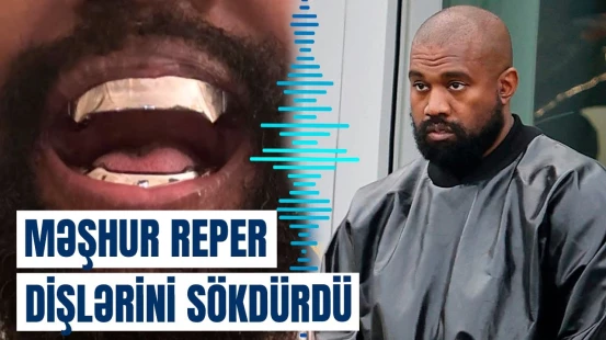 Dişlərinə 850 min dollar “maya qoyan” Kanye Uestdən gözlənilməz addım