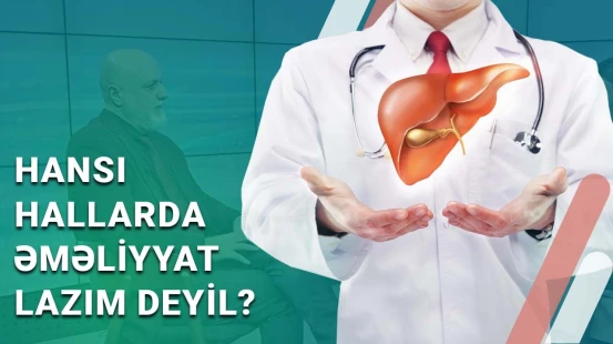 Sirroz, şişlər və orqan köçürülməsi | Qaraciyər xəstəliklərinin müalicəsi
