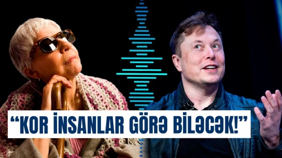 İlon Mask görməni bərpa edən beyin implantı barədə danışdı