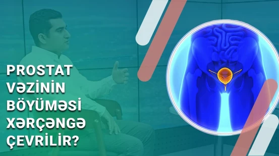 Prostat vəzi adenoması və böyrək daşının müalicəsi | Lazerlə əməliyyatın fərqi - BAKU MED