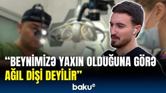 Sonuncu çıxan dişə niyə "ağıl dişi" deyilir? | Həkimdən açıqlama