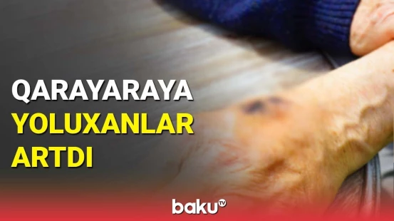 Qarayara xəstəliyinin yayılması ilə bağlı Səhiyyə Nazirliyi və TƏBİB-dən vacib məlumat