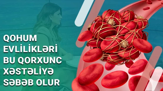 Cavan qalmaq istəyirsinizsə, bunu qətiyyən etməyin | İrsən keçən xəstəliyin səbəbləri - BAKU MED