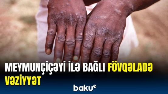 Konqoda yeni virusdan ölənlərin sayında artım | Fövqəladə vəziyyət elan edildi