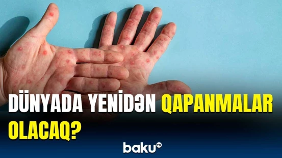 Meymunçiçəyinə görə hərəkətə keçildi | ÜST-dən həyəcan təbili