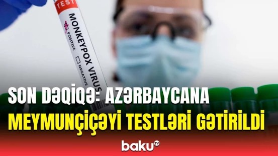 Meymunçiçəyi virusunun əlamətləri açıqlandı | Səhiyyə Nazirliyi məlumat yaydı