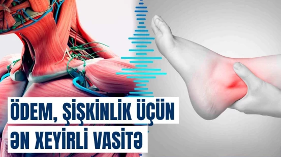 Ödem niyə yaranır? - Axşam ayaqlar, səhər üz, gözlərin altı şişirsə…