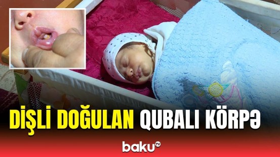 Bizim nəsildə belə bir şey olmayıb | Qubada qeyri-adi körpə doğuldu