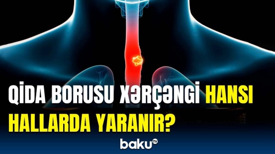 Bu simptomlar olan kimi dərhal... | Qida borusu xərçəngi ilə bağlı həyəcan təbili