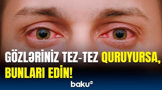 Göz quruluğunun əsas səbəbləri açıqlandı | Həkimlərdən həyəcan təbili
