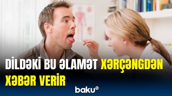 Bu əlamətləri önəmsəmirsinizsə, səhv edirsiniz! - Ağız xərçəngi barədə xəbərdarlıq