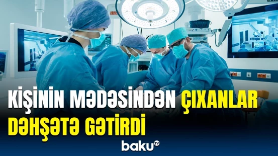 İkigünlük əməliyyatın gözlənilməz nəticəsi | Hindistanda qeyri-adi hadisə