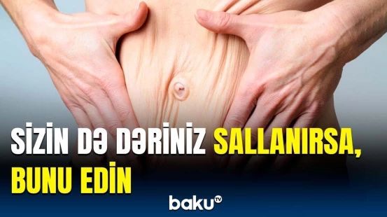 Dəri sallanması, əslində, nədən yaranır? | Mütəxəssislərdən faydalı məsləhət