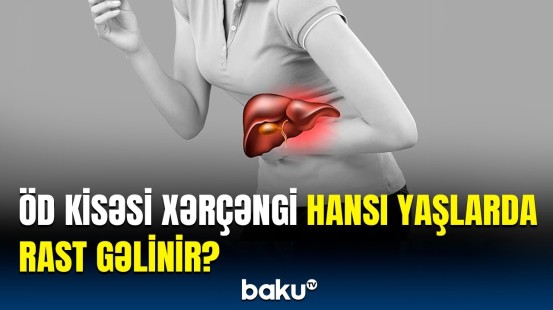 50 yaşına qədər insanlarda xərçəngin yaranma səbəbi | Onkoloqlardan vacib xəbərdarlıq