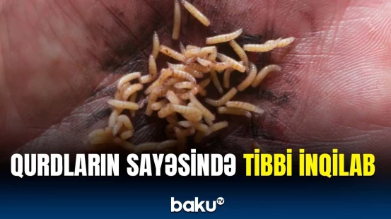 Alimlər ilki gerçəkləşdirdi | Tibb üçün elə bir qurğu hazırlandı ki...