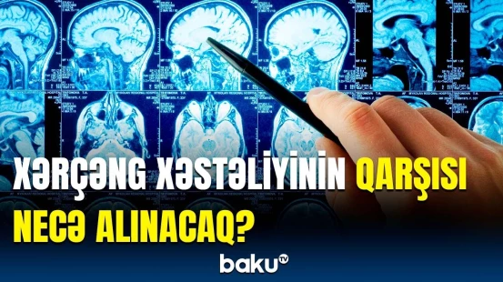 Tibbdə inqilabi irəliləyiş | Xərçəng xəstəliyi ilə bağlı yeni texnologiya