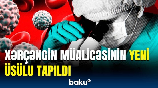 Müalicənin yeni üsulu xərçəngin bu növlərinə tətbiq ediləcək