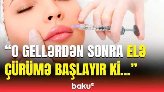 Süni gellərin ölkəyə gətirilməsinə icazə var? - Ağır fəsadları açıqlandı