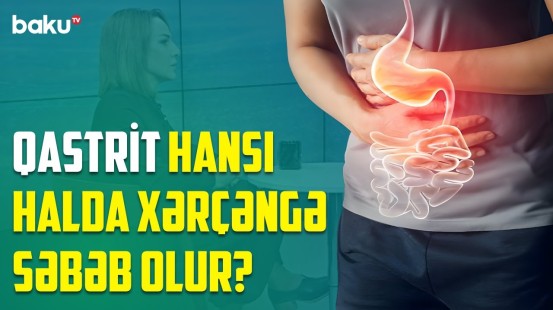 Turşuluq və qıcqırma hissi varsa... | Qastriti olanlar necə qidalanmalıdır? - BAKU MED