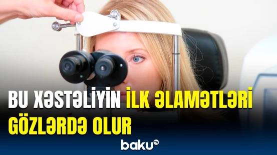 Ciddi xəstəliklərin əlamətlərini belə öyrənin | Alimlərdən inqilabi kəşf