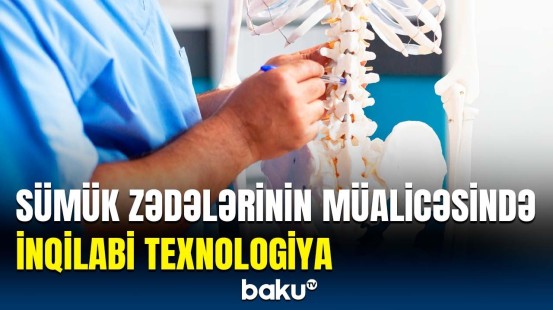 Sümükləri daha tez müalicə edən ixtira | Detallar açıqlandı