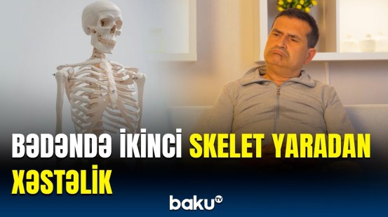 Daş adam xəstəliyi nədir? | Əgər bu əlamətlər varsa...