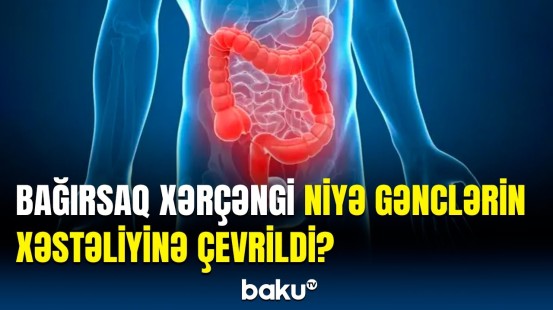 Mütəxəssislərdən işlənmiş qidalarla bağlı vacib xəbərdarlıq