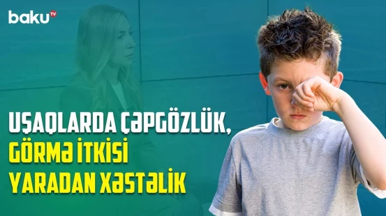 Tez-tez gözünə əl atırsa... | Uşaqlarda ən çox yaranan göz xəstəliklərinin əlamətləri - BAKU MED