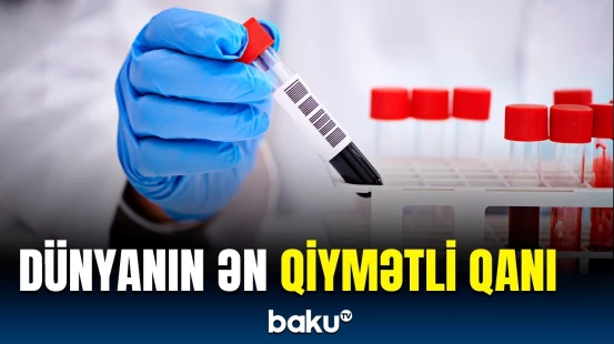 15 min dollara satılan qanın özəllikləri | Milyonlarla insanın həyatını qurtardı…